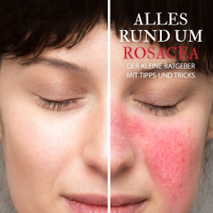 Alles Rund um Rosacea - Der kleine Ratgeber mit Tipps und Tricks