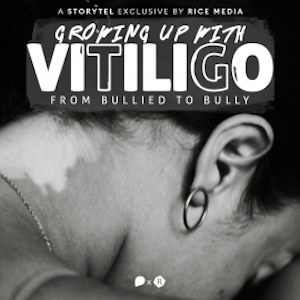 Growing Up With Vitiligo, I Was Bullied—Until I Became A Bully