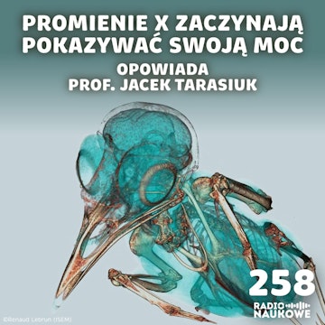 #258 Potęga Roentgena – dawne odkrycie, które dziś weryfikuje niejedną teorię | prof. Jacek Tarasiuk